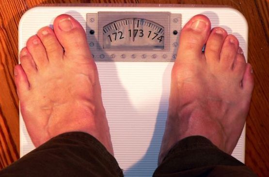 Tribunal garante cirurgia para homem que, com 173 quilos, sofre de obesidade mórbida